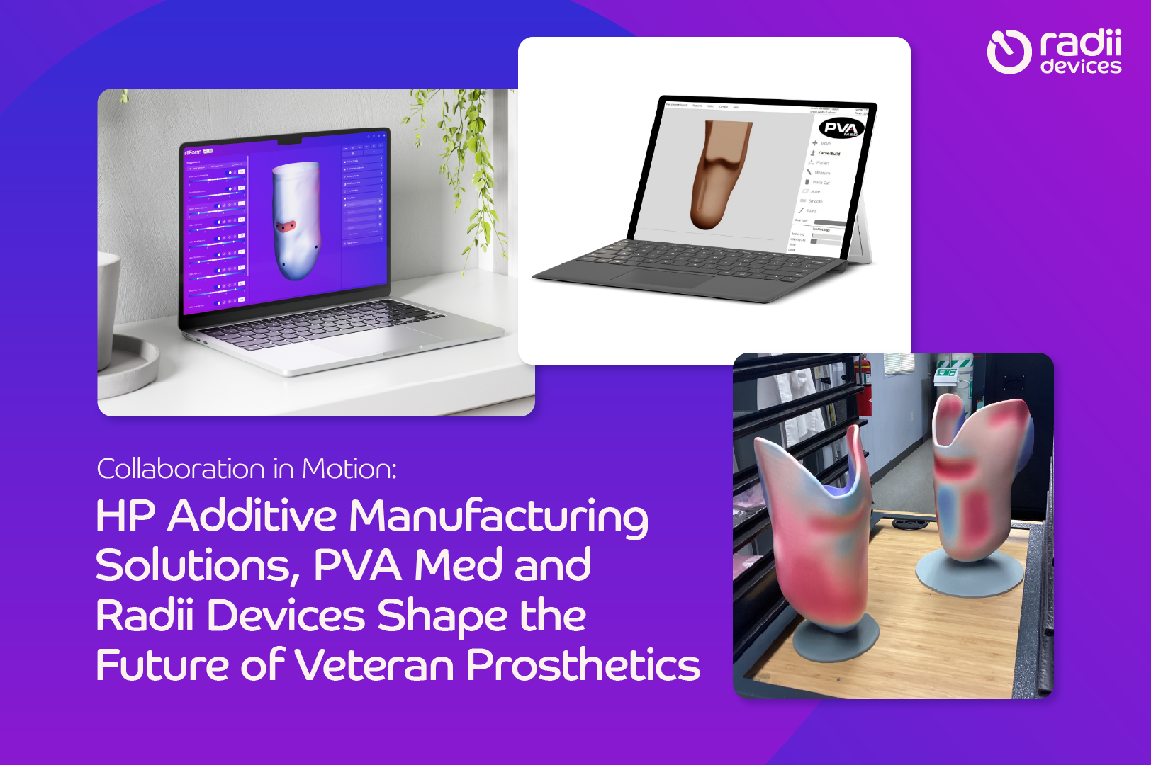 riiForm and PVA Med software, alongside two 3D printed sockets from HP